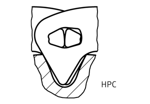 Renold HPC驅(qū)動(dòng)齒形鏈和鏈輪